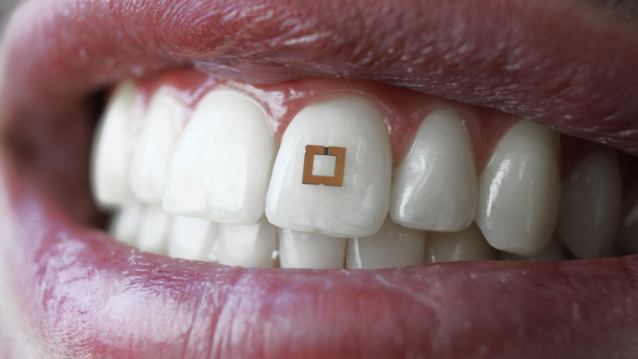 Sensor umieszczony na zębach, pozwoli wspomóc Twoją dietę [1]