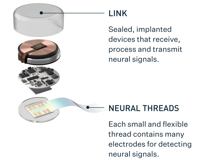 Neuralink: Małpa grająca w Ponga bez użycia rąk. Mózg dziewięcioletniego zwierzęcia zastąpił tradycyjne kontrolery [3]