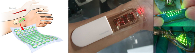 Samsung opracował rozciągliwy wyświetlacz OLED z funkcją monitorowania aktywności użytkownika [2]