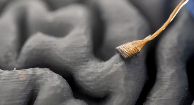 Implant mózgowy BrainGate2 pozwala sparaliżowanym mówić i śpiewać. Technologia UC Davis działa błyskawicznie i dokładnie [2]
